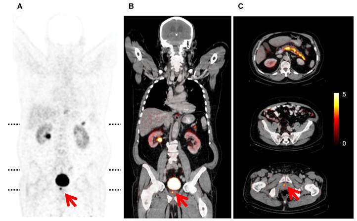 Theranostics Image