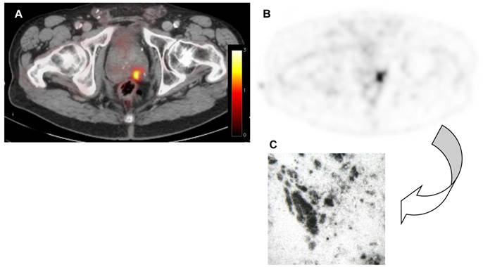 Theranostics Image