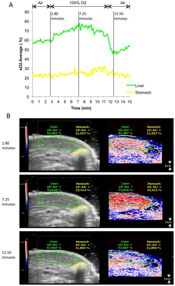 Theranostics Image