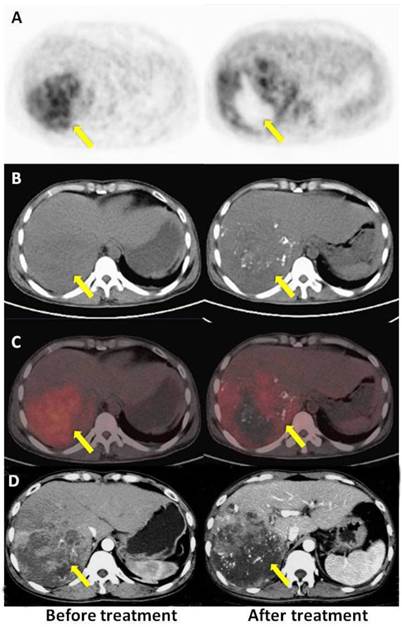 Theranostics Image