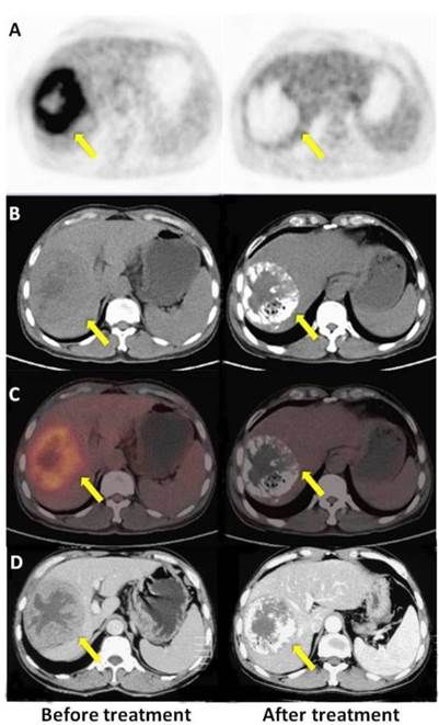 Theranostics Image