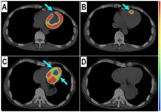 Theranostics Image