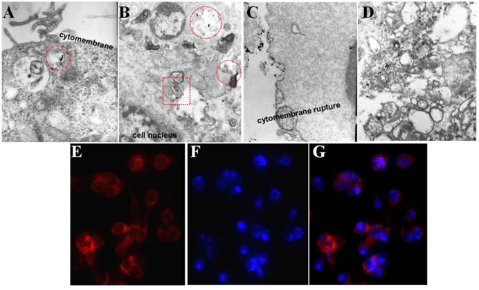 Theranostics Image