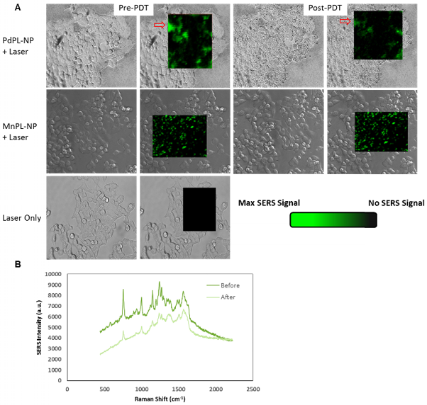 Theranostics Image