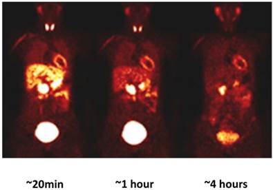 Theranostics Image