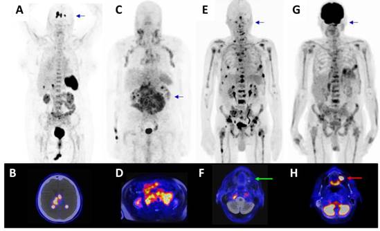 Theranostics Image