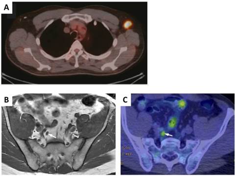 Theranostics Image