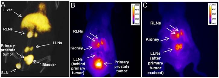 Theranostics Image