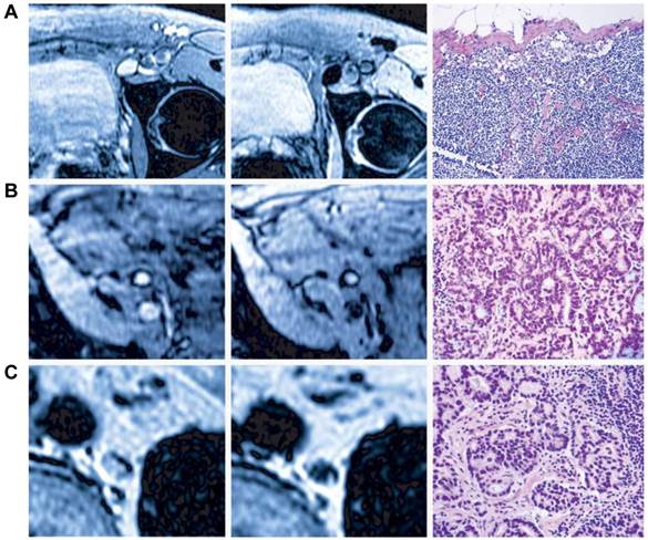 Theranostics Image