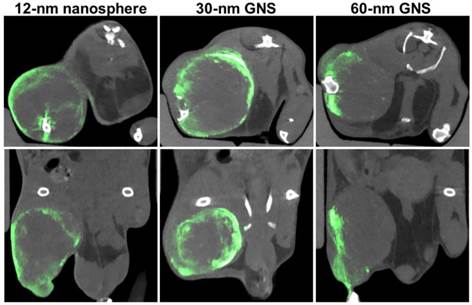 Theranostics Image