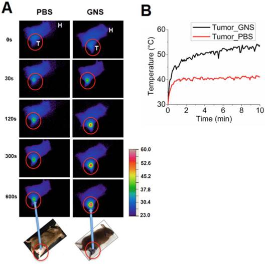 Theranostics Image