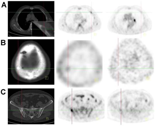 Theranostics Image