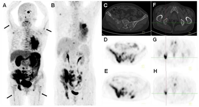 Theranostics Image