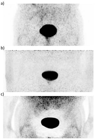 Theranostics Image