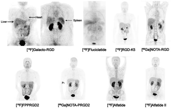 Theranostics Image