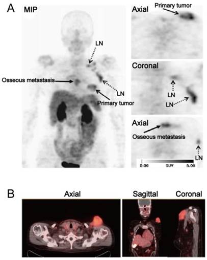 Theranostics Image