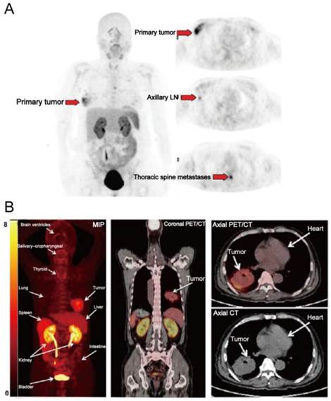 Theranostics Image