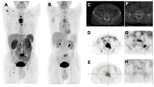 Theranostics Image