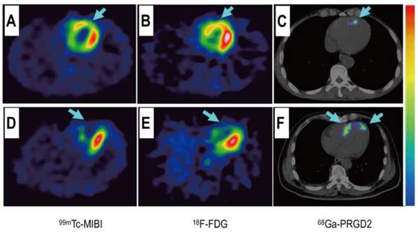 Theranostics Image