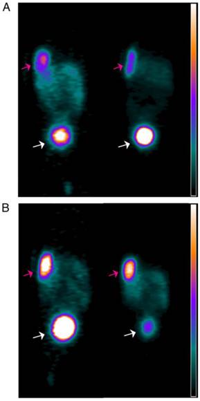 Theranostics Image