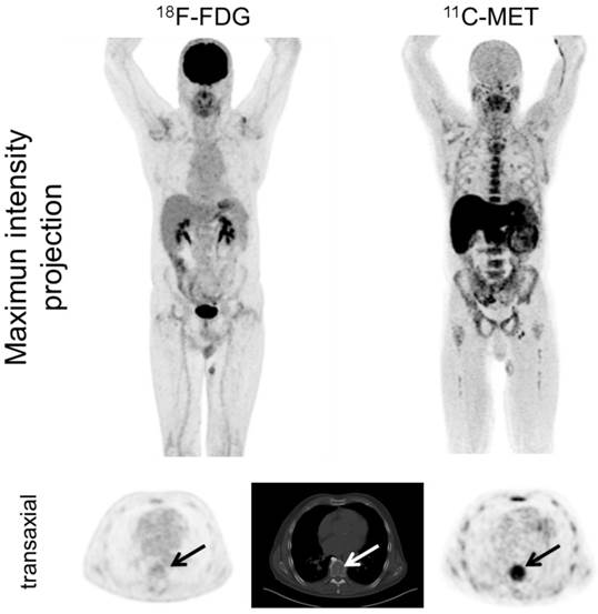 Theranostics Image