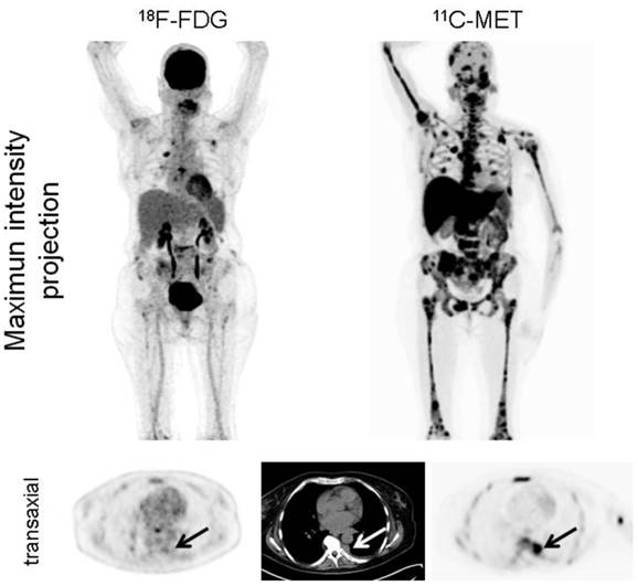 Theranostics Image