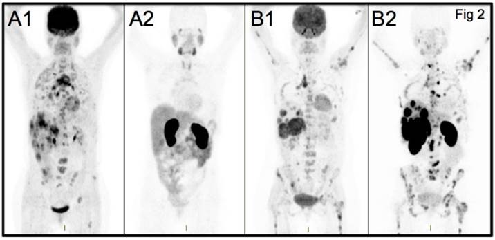 Theranostics Image