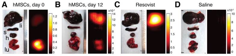 Theranostics Image