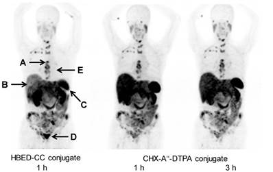 Theranostics Image