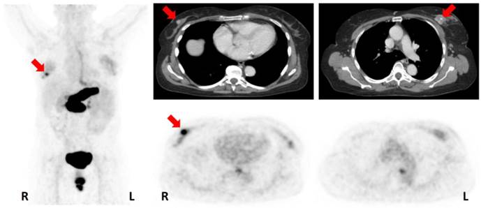 Theranostics Image