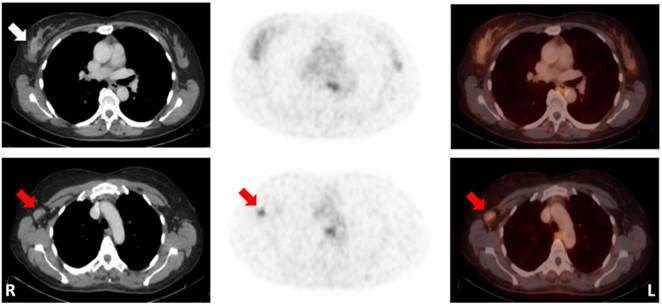 Theranostics Image