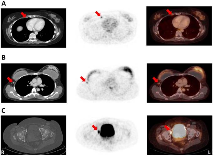 Theranostics Image