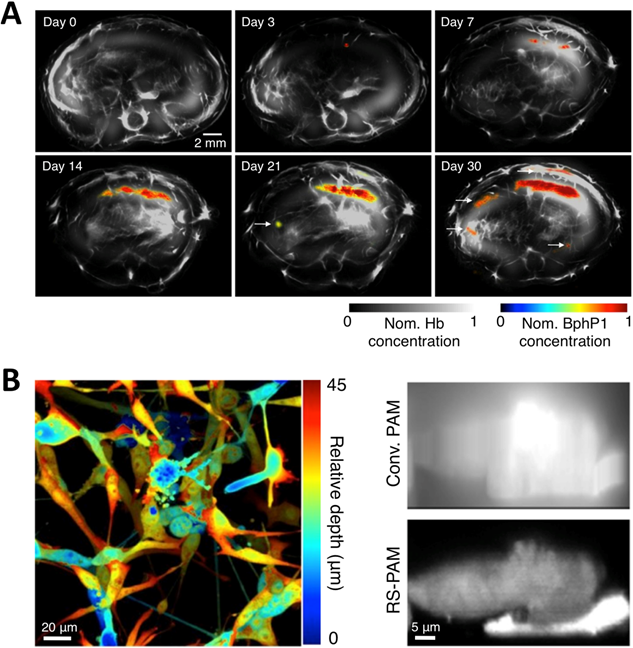 Theranostics Image