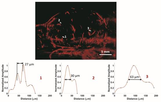 Theranostics Image