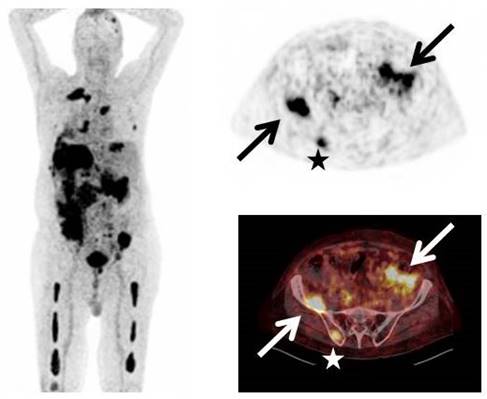 Theranostics Image