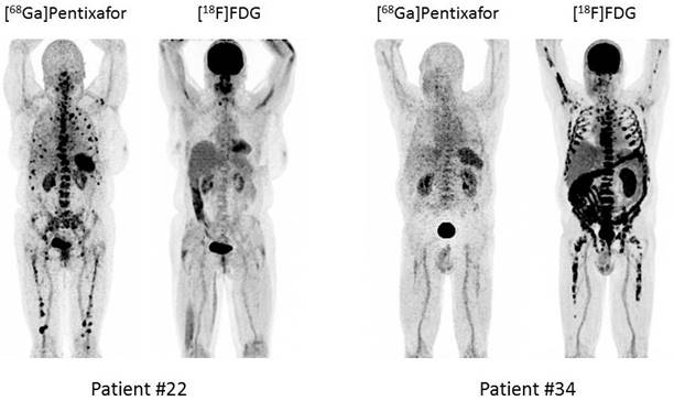 Theranostics Image