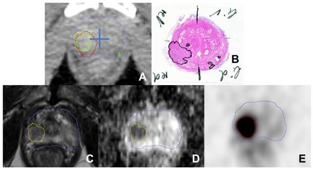 Theranostics Image