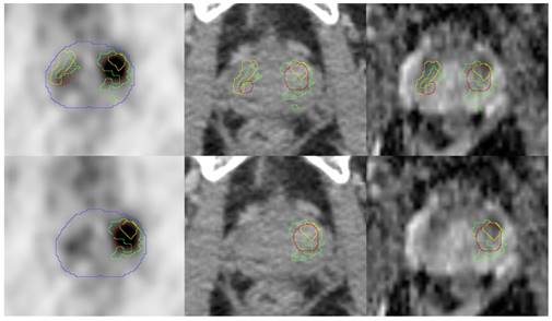 Theranostics Image