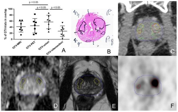 Theranostics Image