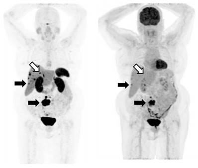 Theranostics Image