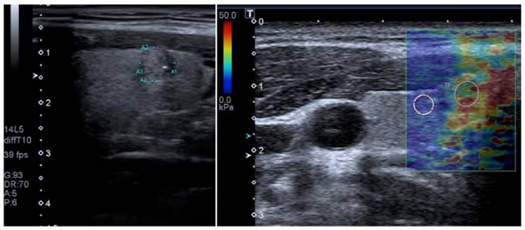 Theranostics Image