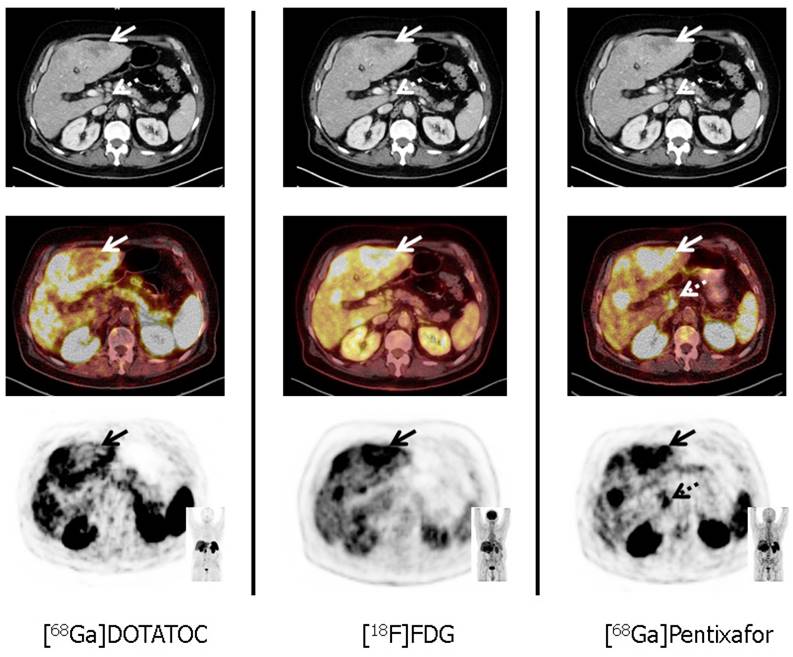 Theranostics Image