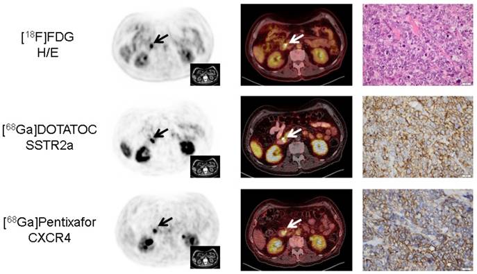 Theranostics Image