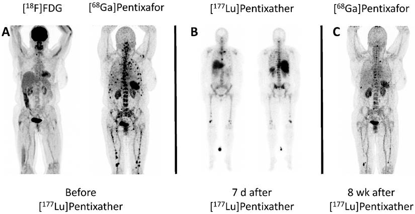 Theranostics Image