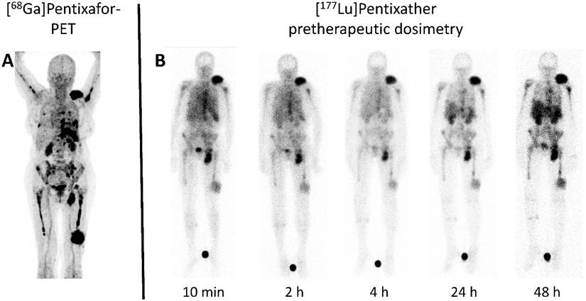 Theranostics Image