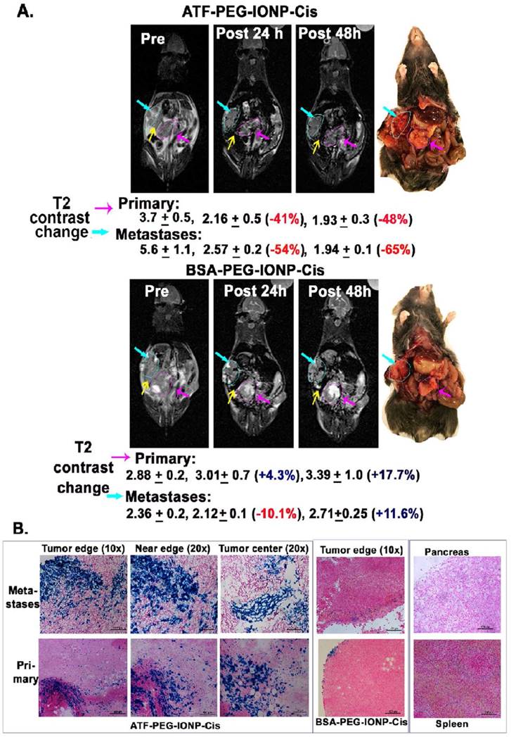 Theranostics Image