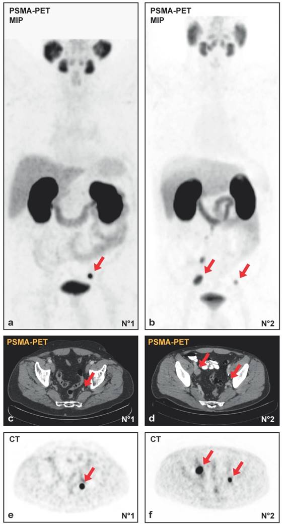 Theranostics Image