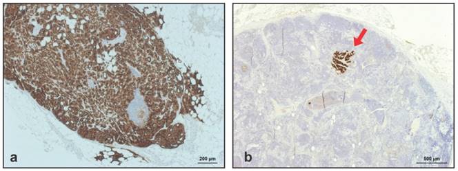 Theranostics Image