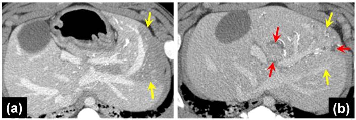 Theranostics Image