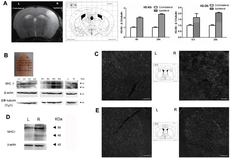 Theranostics Image